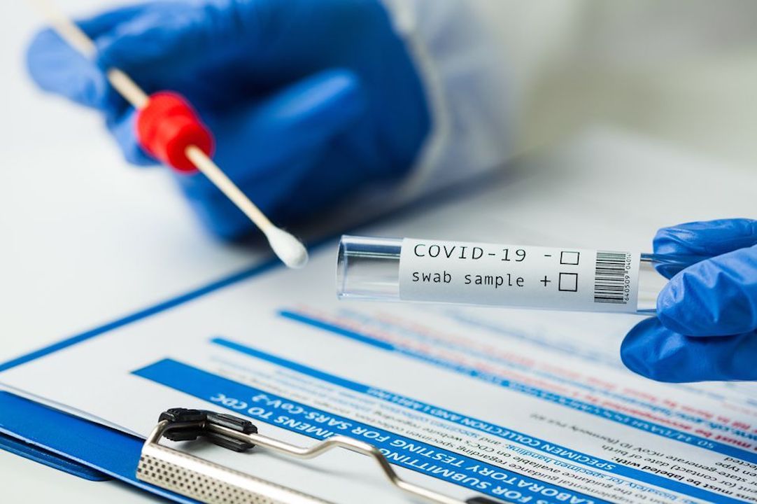 ΔΩΡΕΑΝ ΤΕΣΤ COVID 19 στο Δήμο Ανατολικής Σάμου