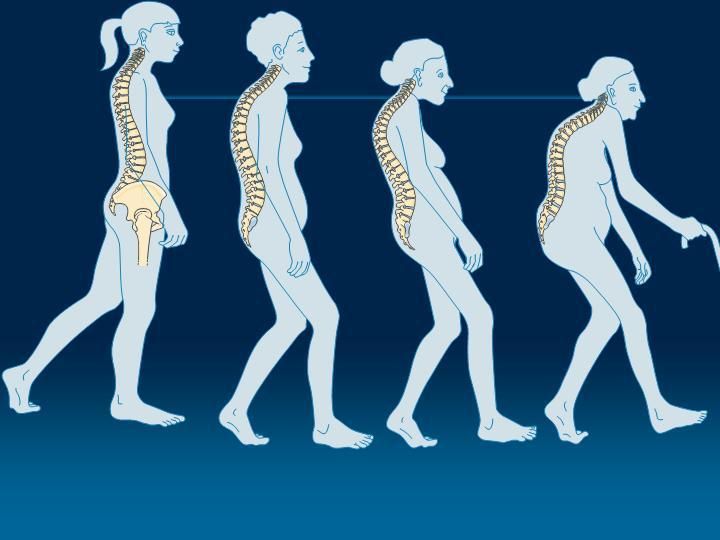 Εξωτερικό Ιατρείο Οστεοπόρωσης στο νοσοκομείο Σάμου